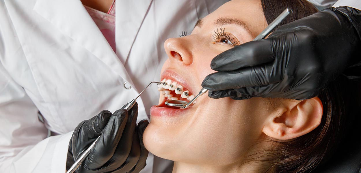 Why Orthodontic Treatment Alone May Not Treat Some Diastemas
