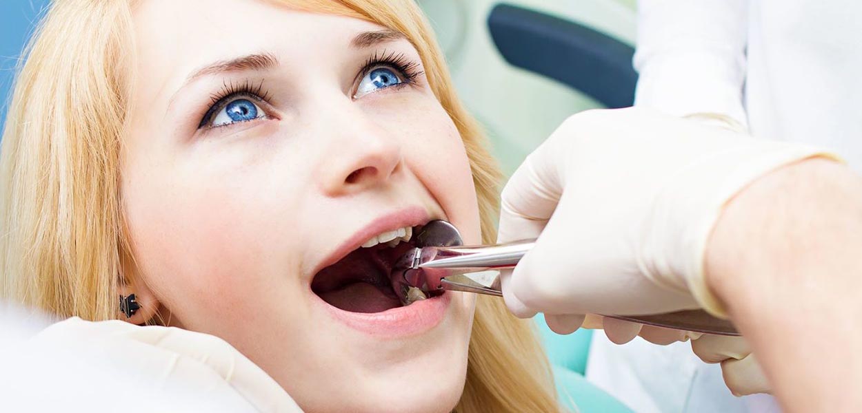 Adults Need Teeth Pulled Before Getting Braces