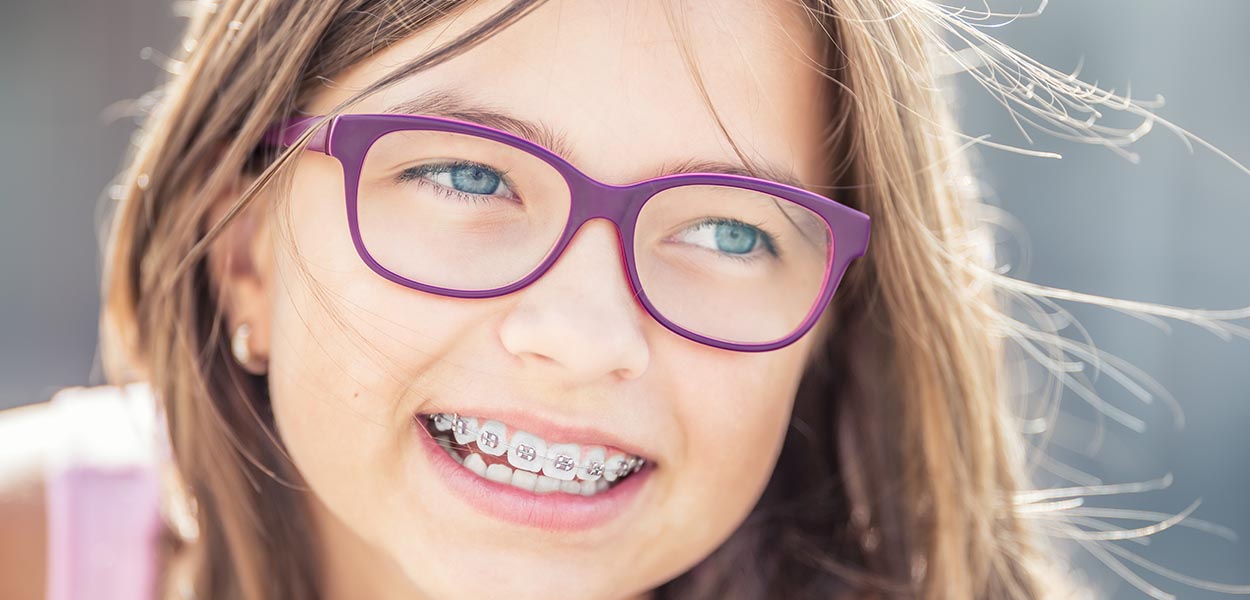 Affordable braces cost